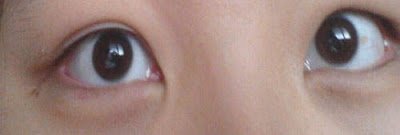 雙眼皮化妝術