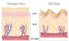 年輕老化肌膚比較圖