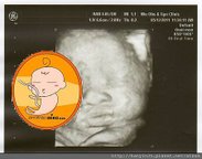 20110512mikobaby01拷貝.jpg