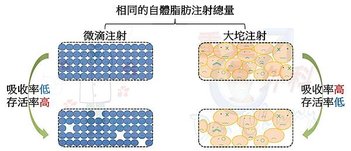 陰莖脂肪增大與入珠的分際—個案探討篇(The beading