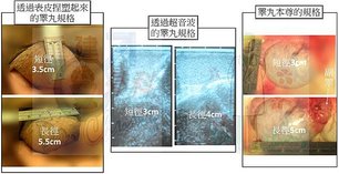 外生殖器相片的啟示與判讀(下)(The hint &amp; ana