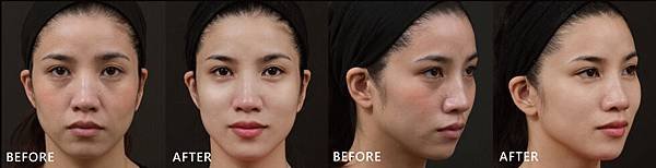 Hyaluronic-Sherry-ba