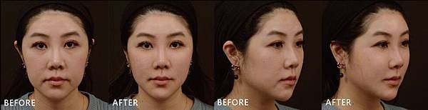 Hyaluronic-claire-ba