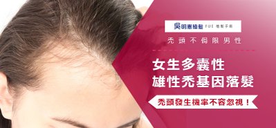 台中植髮推薦│禿頭不侷限男性，女生多囊性雄性禿基因落髮，禿頭發生機率不容忽視！植髮解決女性禿頭危機.jpg