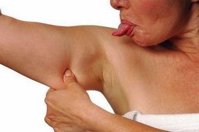 upper-arm-fat