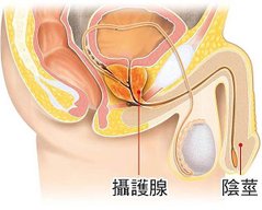 攝護腺1