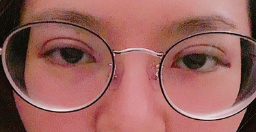 Mu術後.png