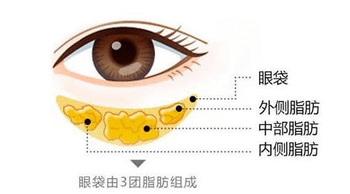 去皺去眼袋