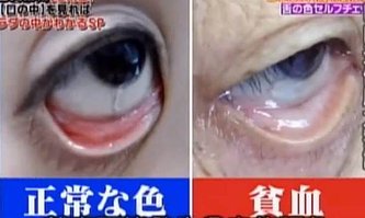 眼臉血色