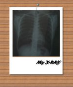 x-ray-1.jpg