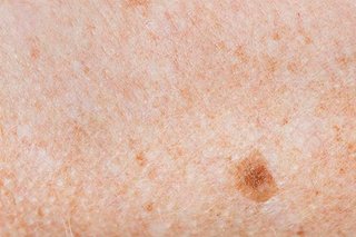 closeup-freckled-skin_53876-20500.jpg