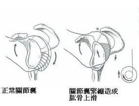 手舉不高