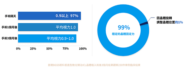 不旋轉‧垂直型散光矯治ICL植入式微型鏡片手術 V-Tori