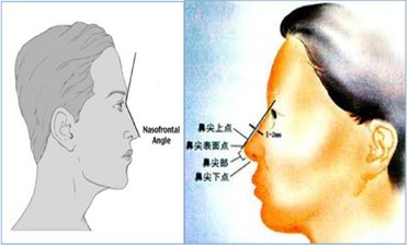 楊醫師隆鼻-5