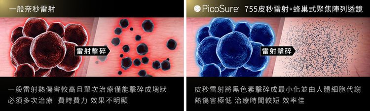 PicoSure755蜂巢皮秒雷射介紹皮秒雷射價格雷射保養膠原蛋白美肌博士超皮秒二代皮秒新一代皮秒 (2).jpg