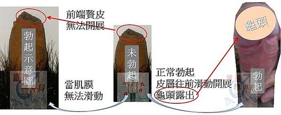 陰莖勃起演示圖.jpg