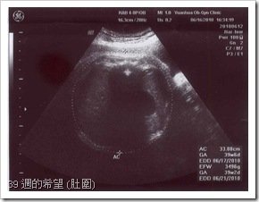 39 週的希望 (肚圍)