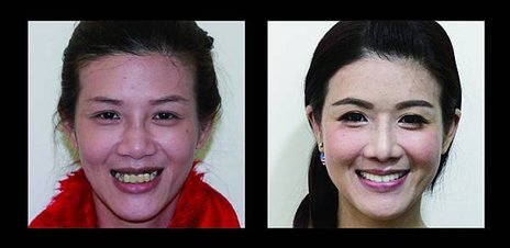 自信人生，從齒開始