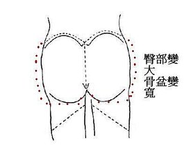 產後骨盆變 寬2