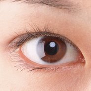 雙眼皮類型1