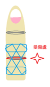 手指白貼示意圖.png
