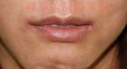 lip2_副本1