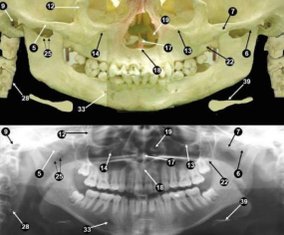 panoramic-anatomy-2-728