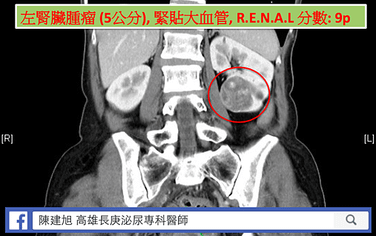 螢幕快照 2020-04-12 10.56.19.png