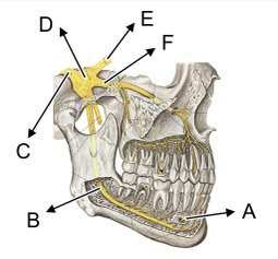 Neurálgia-de-trigémino-Diagnostrum