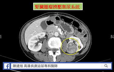 螢幕快照 2020-04-12 10.57.01.png