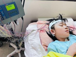 控制不了的癲癇(六)-術後藥物控制中