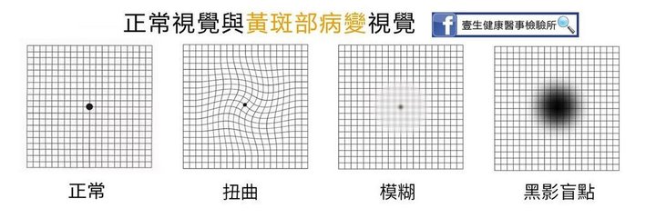 阿姆斯勒方格表2.jpg