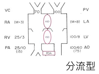 分流型.PNG