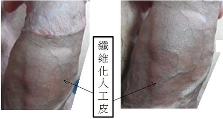 看見人工皮.jpg