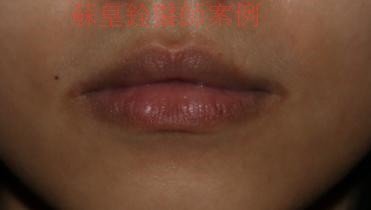 lip