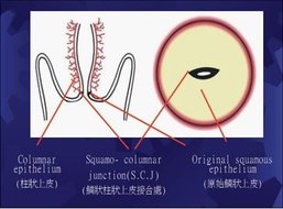 婦科採集子抹技巧