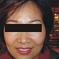 奈米光美膚儀01-1.jpg