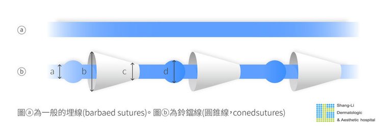 埋線拉皮埋線拉皮費用臉部埋線價格埋線拉皮術後埋線拉提推薦埋線拉皮ptt埋線拉皮效果鈴鐺線拉提上立皮膚科林上立02.jpg