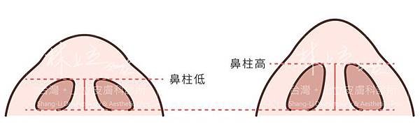 洢蓮絲隆鼻洢蓮絲ellanse聚己內酯PCL依戀詩易麗適少女針微晶瓷晶亮瓷隆鼻03.jpg