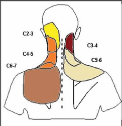 The-patterns-of-referred-pain-from-the-cervical-zygapophysial-joints-7.png