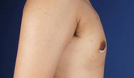 男性女乳12.jpg