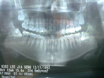 20120309634