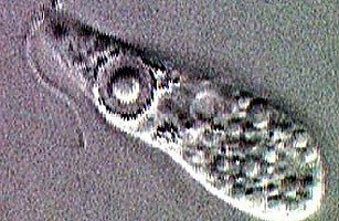 巴基斯坦出現專吃大腦寄生蟲(brain-eating
                amoeba) - 巴基斯坦專吃大腦寄生蟲
