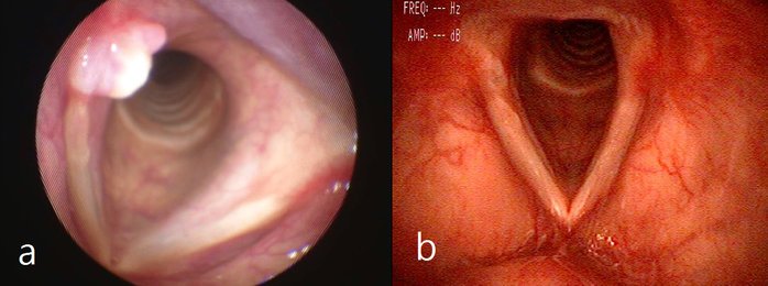 Figure1