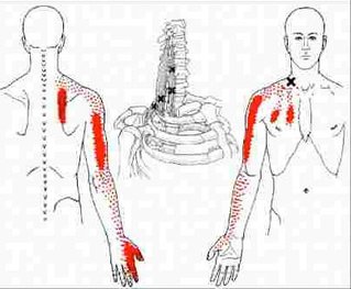 trigger points.jpg