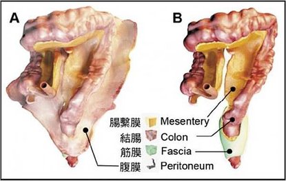 mesen02.jpg