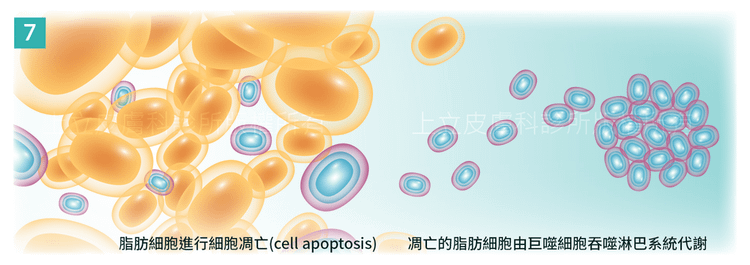 MICOOL-S冷凍溶脂效果冷凍溶脂價錢冷凍減脂心得冷凍溶脂推薦冷凍溶脂ptt冷凍溶脂原理冷凍溶脂術後瘦肚子的方法快速瘦肚子運動瘦肚子按摩快速瘦小腹運動瘦肚子飲食瘦肚子07.png