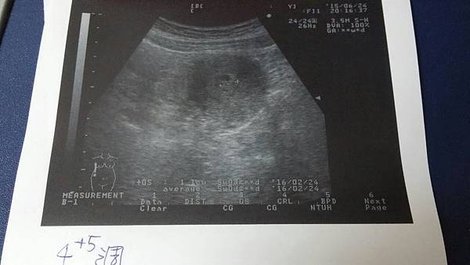 0624 5w4d