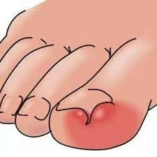 下載.jpeg