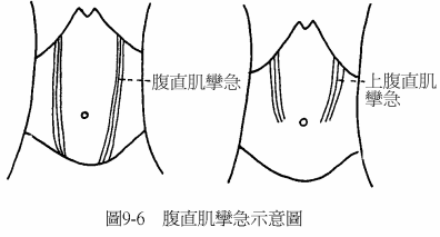 胃2.gif